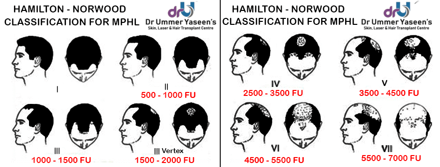 Hair Transplant Srinagar Kashmir